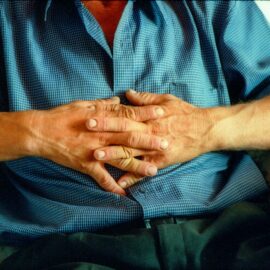 CARDIOPATÍA ISQUEMICA: Infarto de miocardio