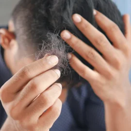 Caída del cabello: por qué se cae el pelo y cuándo hay que preocuparse