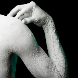 Sarna (escabiosis): cómo se contagia, cómo se trata y qué hacer con la ropa