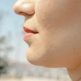 Herpes labial (calenturas) y sol: cómo cortar el brote y evitar que vuelva